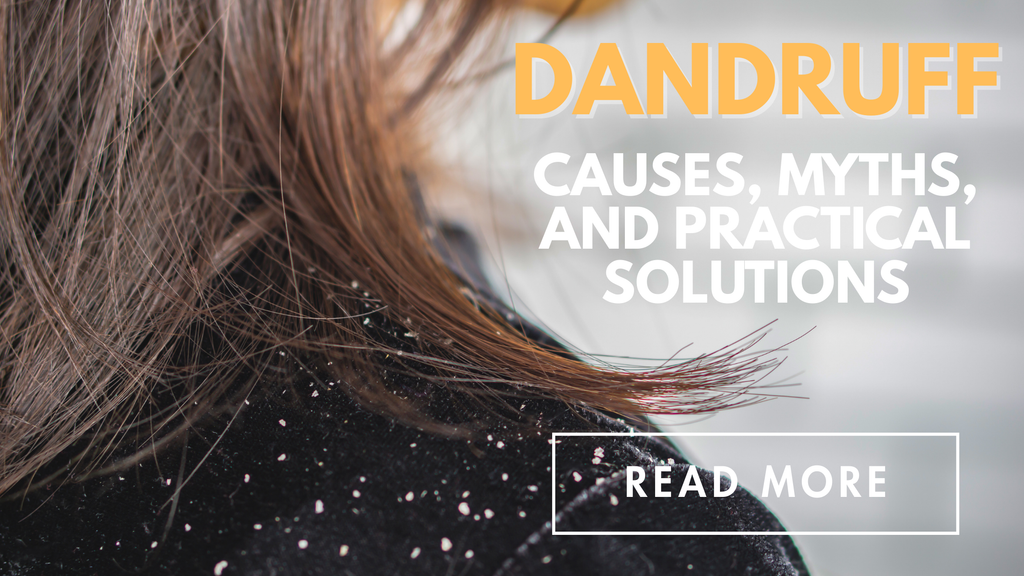 Dandruff: Causes, Myths, and Practical Solutions